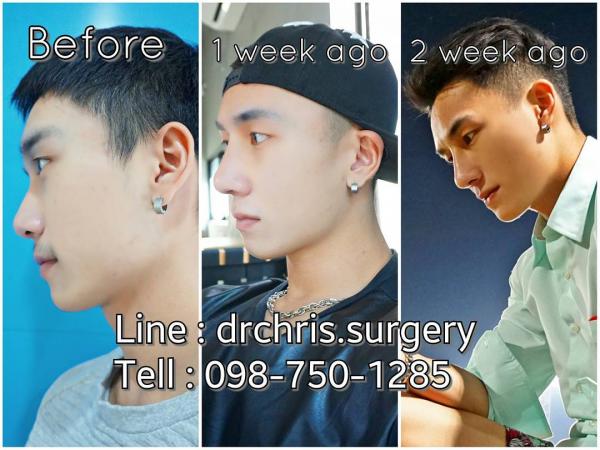 Hunger-Homme--Ice-Ratawit